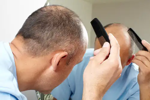 Hair Surgery Risk Factors