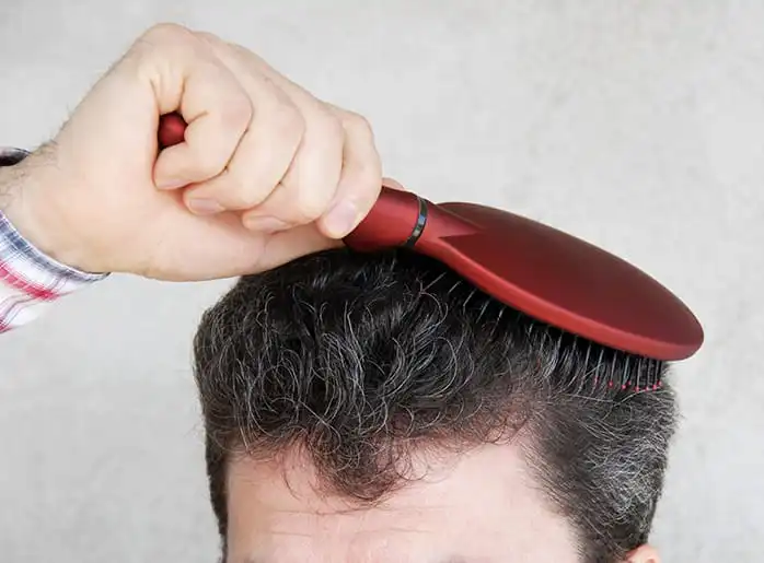 Do Hair Transplants Really Work?
