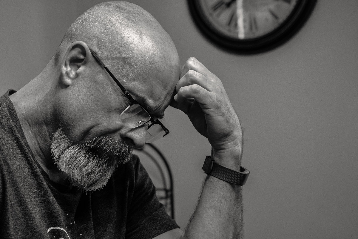 What Causes Hair Loss?