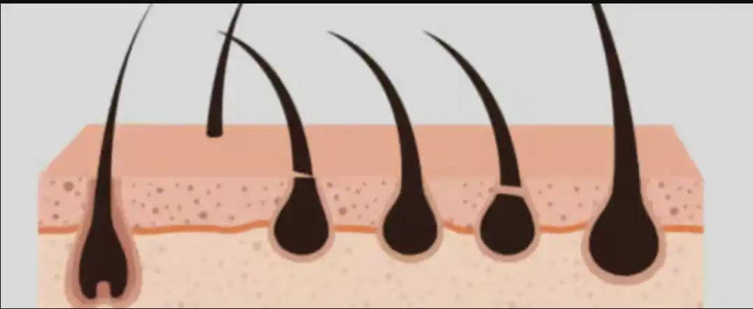New Hair Growth Breakthrough