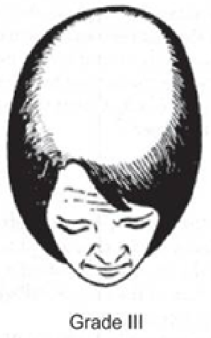 Ludwig Scale Grade 3 Image of the Ludwig scale grade 3.