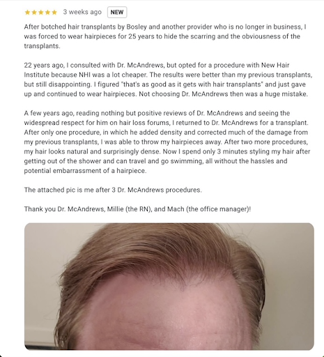 Botched Transplant Correction Review