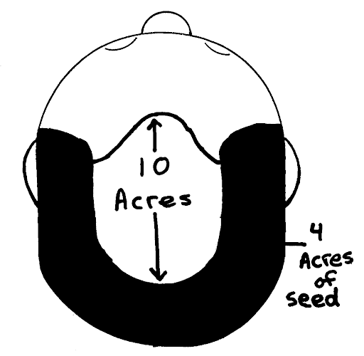 Limitations of a hair transplant.