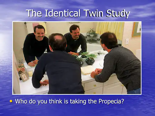 finasteride twin challenge