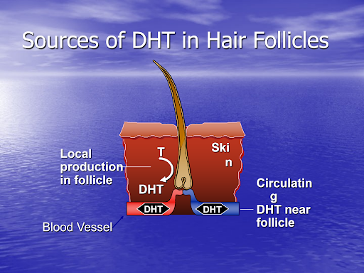 Sources of DHT in hair follicles