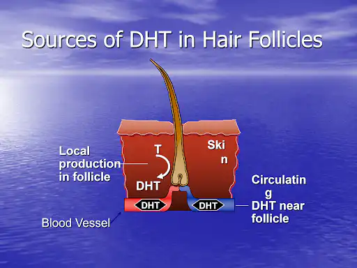 Sources of DHT in hair follicles